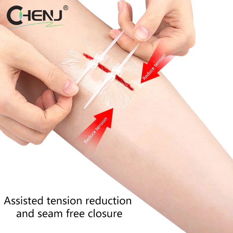 

Zipper Tie Wound Closure Patch Zipper Band-Aid Wound Fast Suture Outdoor Portable Hemostatic Patch First Aid Tool