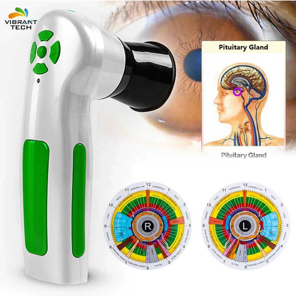 Digital iridology Recoridng Device eye iriscope 12MP