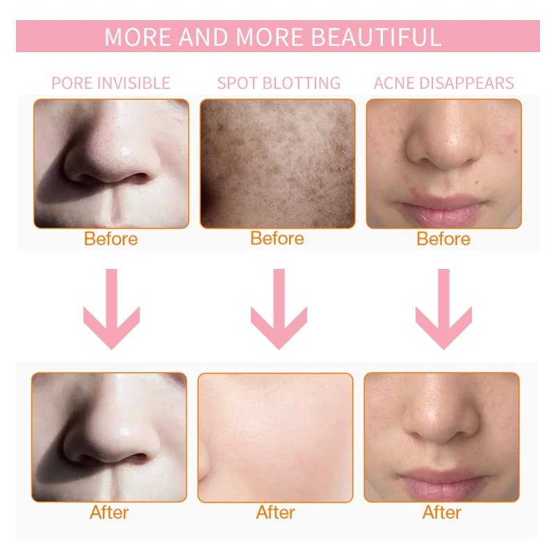 Maschera per il viso a LED con collo 7 colori Photon Antirughe Schiarente per la pelle Collo Maschera di bellezza Rimozione delle rughe Rafforzamento della pelle Bellezza