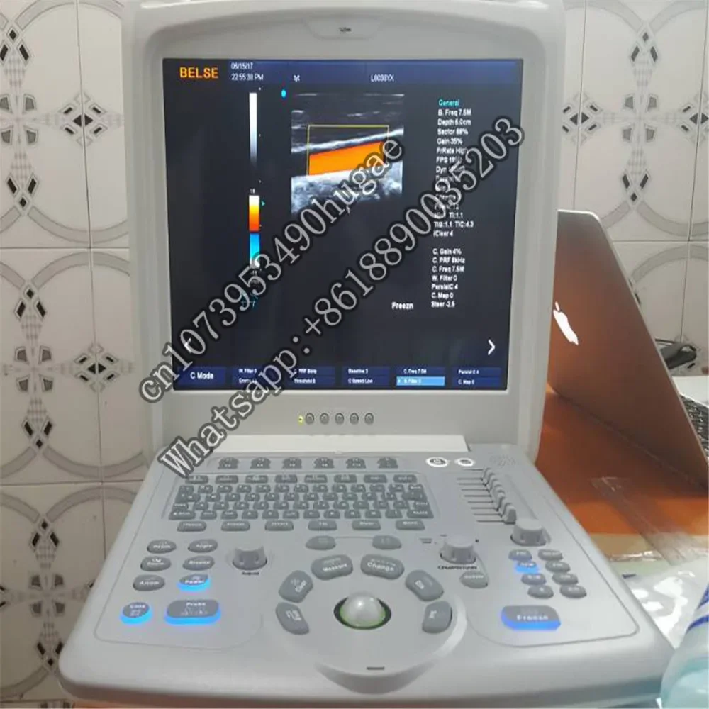 SZMIQU Ecography Echo Doppler Ultrasound & 3d Gynecologic preg--nancy s Product Portable Medical  Instruments