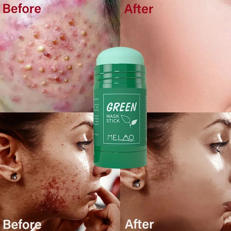 

2023 New Melao Skin Repair Acne Remove Mud Mask Organic Green Tea Mask Stick Clay Mask Stick 40g For Women