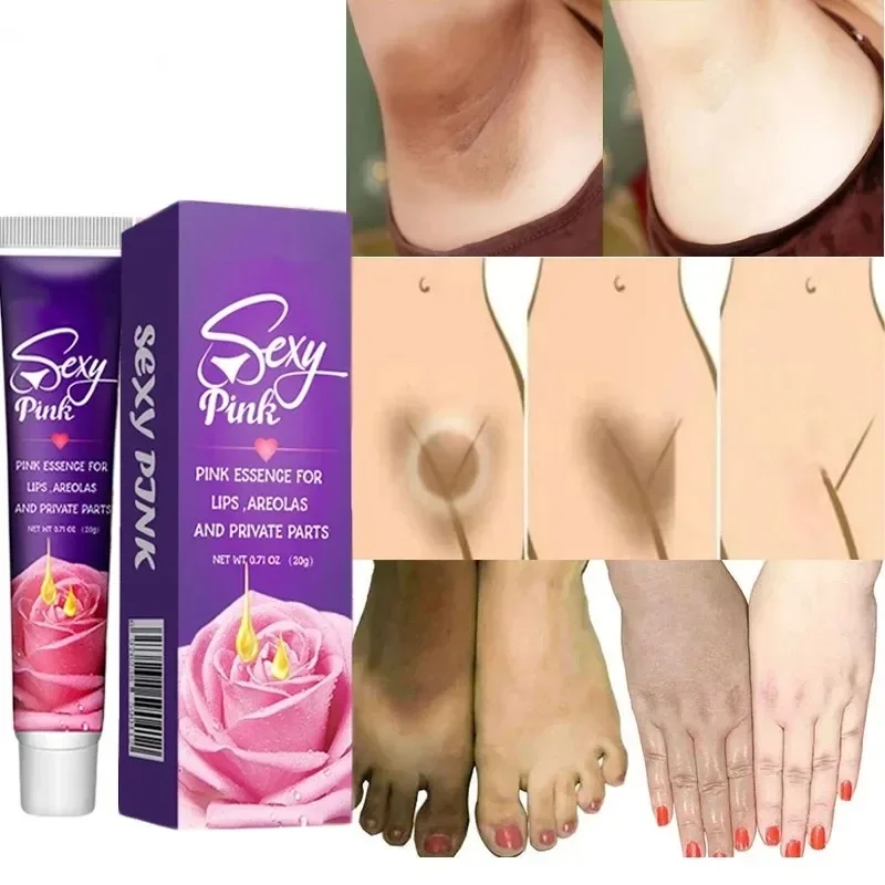 

Body Intimate Parts Whitening Cream Knees Hips Remove Dull Pigment Brightening Serum Whitening Lips Whitening Inner Thighs