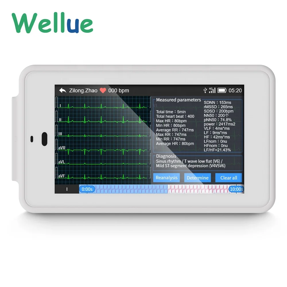 Wellue PCECG 500 Freeze Function 24 Hours Handheld 12 Lead ECG Machine ECG Device For Sale Wearables ECG