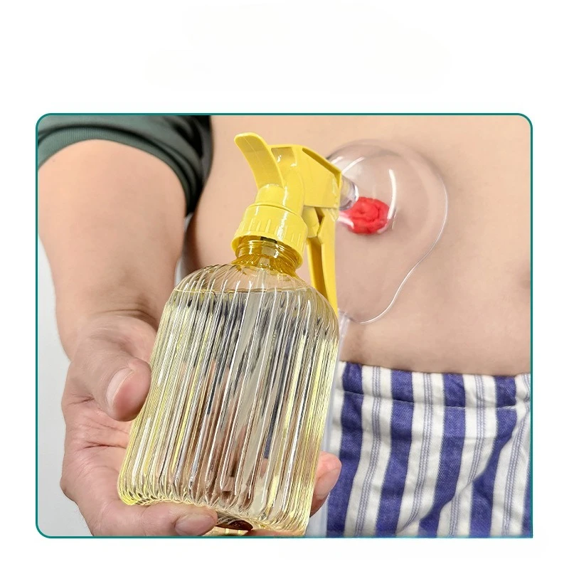 Washing Bottle for Ostomy Bag Stoma Cleaning Tank - Cleans The Rectal Stoma Stoma Cleaning Device