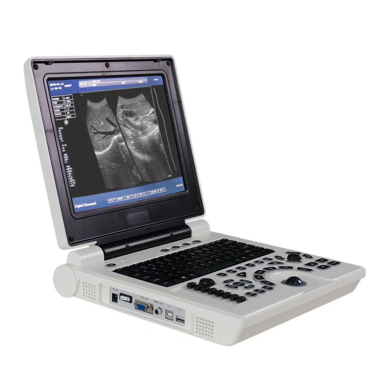 

WUB-P1 Portable Full Digital B Mode Veterinary Laptop sheep canine ultrasound machine