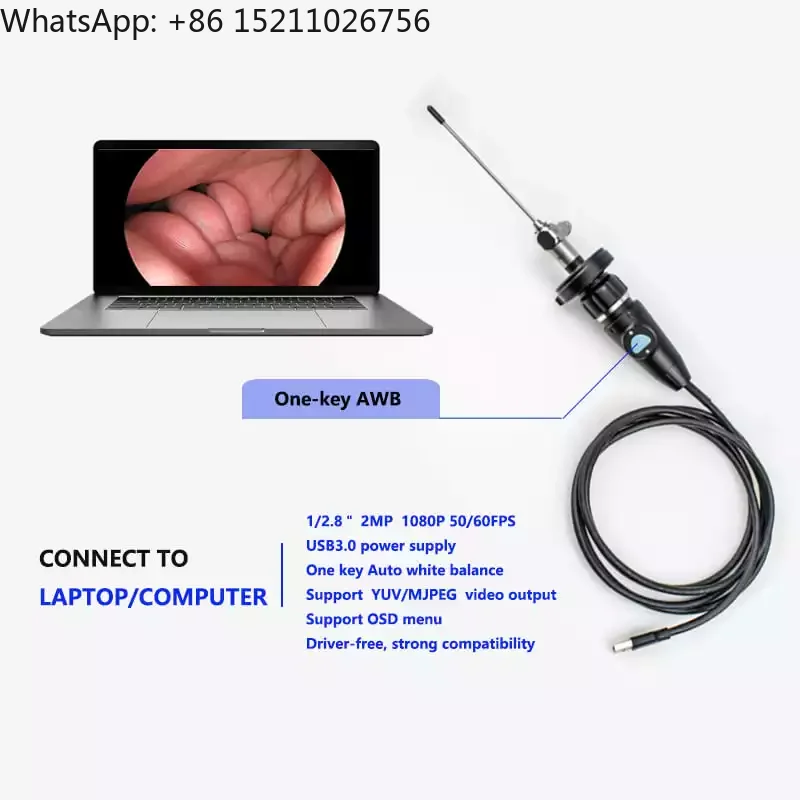 Full HD CMOS Medical Portable USB Endoscope Camera for ENT Nasal Otoscope Ear Laparoscopic Gynecology