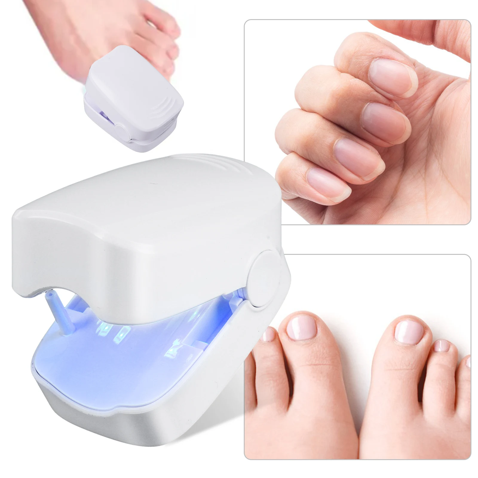 Nail Fungus Cleaning Device Fungus Discolored Remover Portable Nail Fungus Eradication Device for Toenail Fungus & Onychomycosis