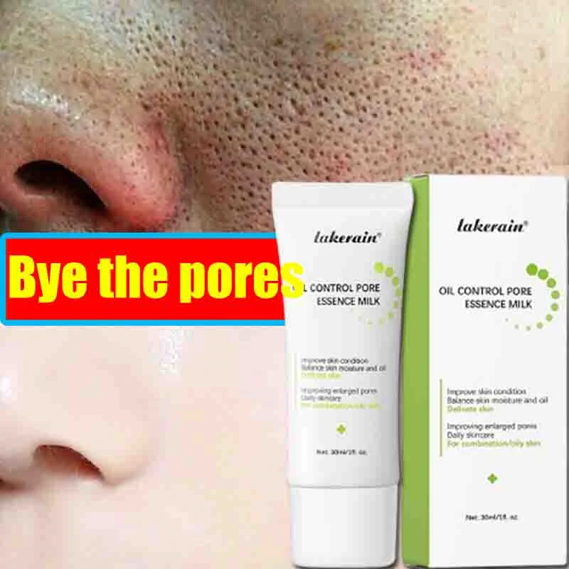 Crema restringente i pori Prodotto per la riparazione del pozzo dell'acne per uomini Donne Rimuovi la cicatrice della stampa dell'acne Crema per la pelle liscia anti-inflamatoria dei pori grandi