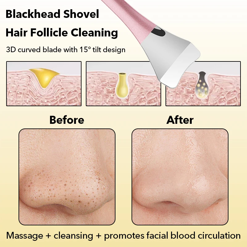 Roestvrij mee-eter verwijderingsgereedschap Gezichtsschraper Huid Scrubber Gezichtsspatel voor diepe poriënreiniging Schoonheid Huidverzorging