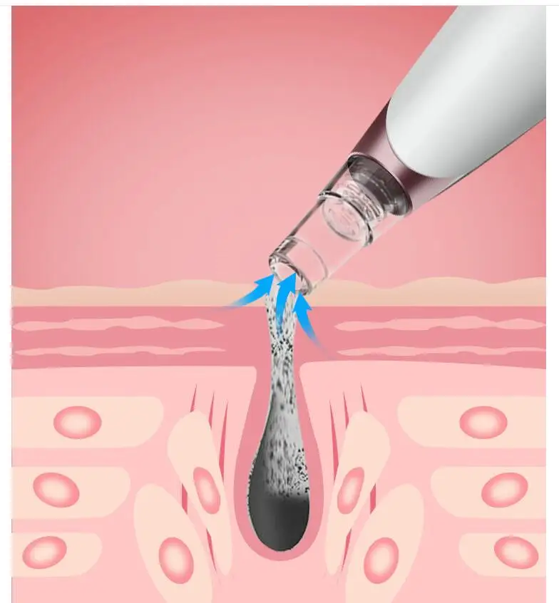 blackhead remover,Skin Care Pore Vacuum Acne Pimple Removal Vacuum Suction Tool Facial Diamond Dermabrasion Machine Face Clean