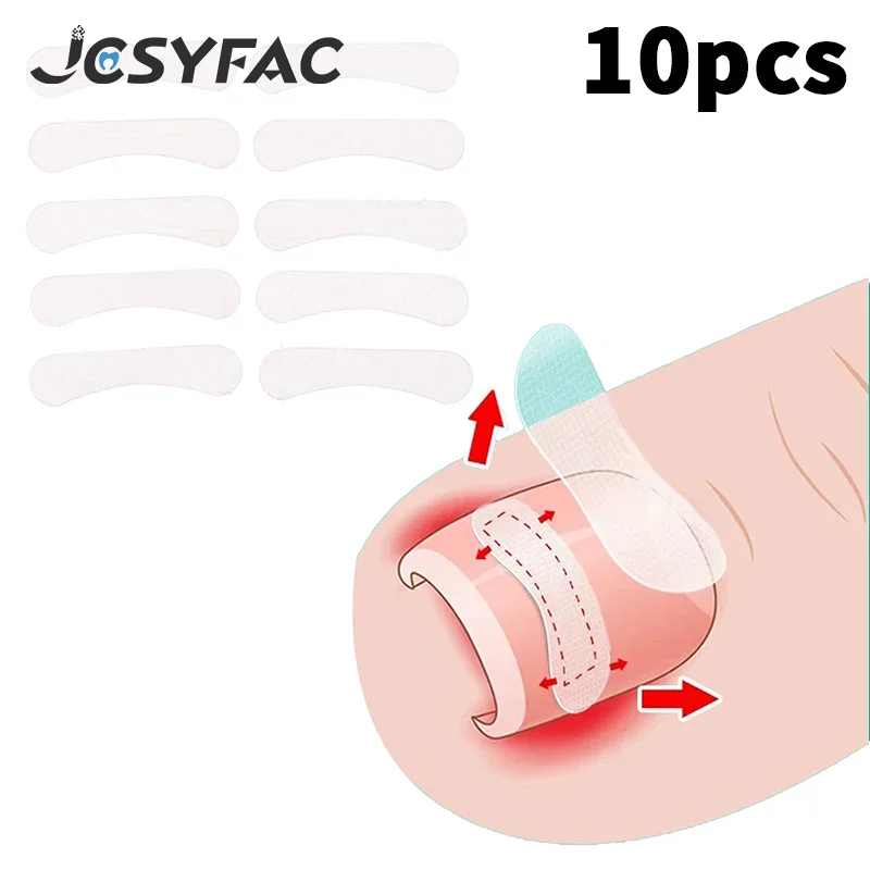 10 個陥入爪矯正ツール矯正クリップブレース陥入爪治療弾性パッチステッカーペディキュアツール