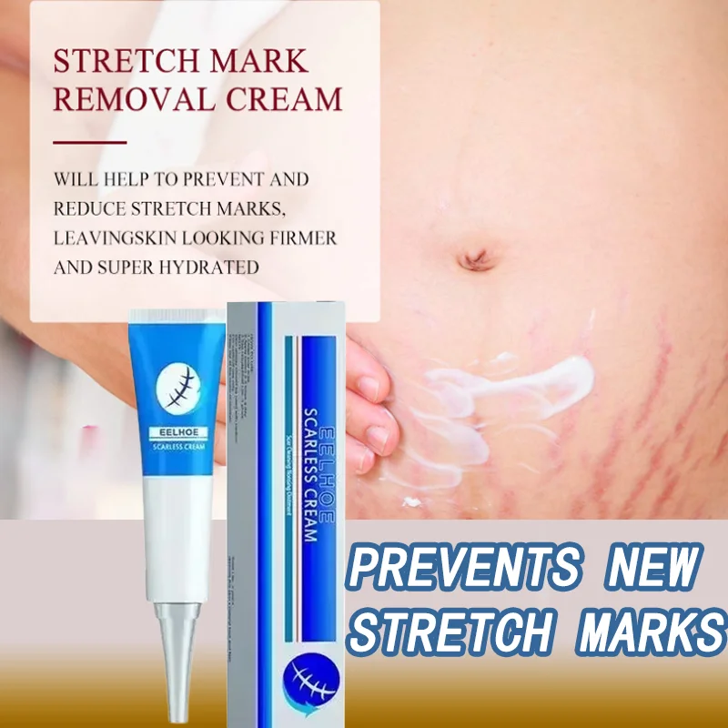 

Eliminate Red White Old Stretch Marks Cream Anti-wrinkle remove Stretch Mark Maternal Skin Repair Remove Pregnancy Body Skin
