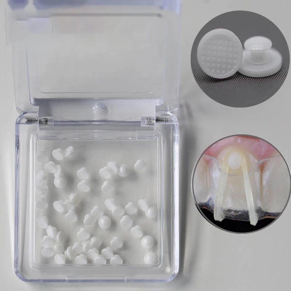 Рисунок 5 - стоматологическая ортодонтия