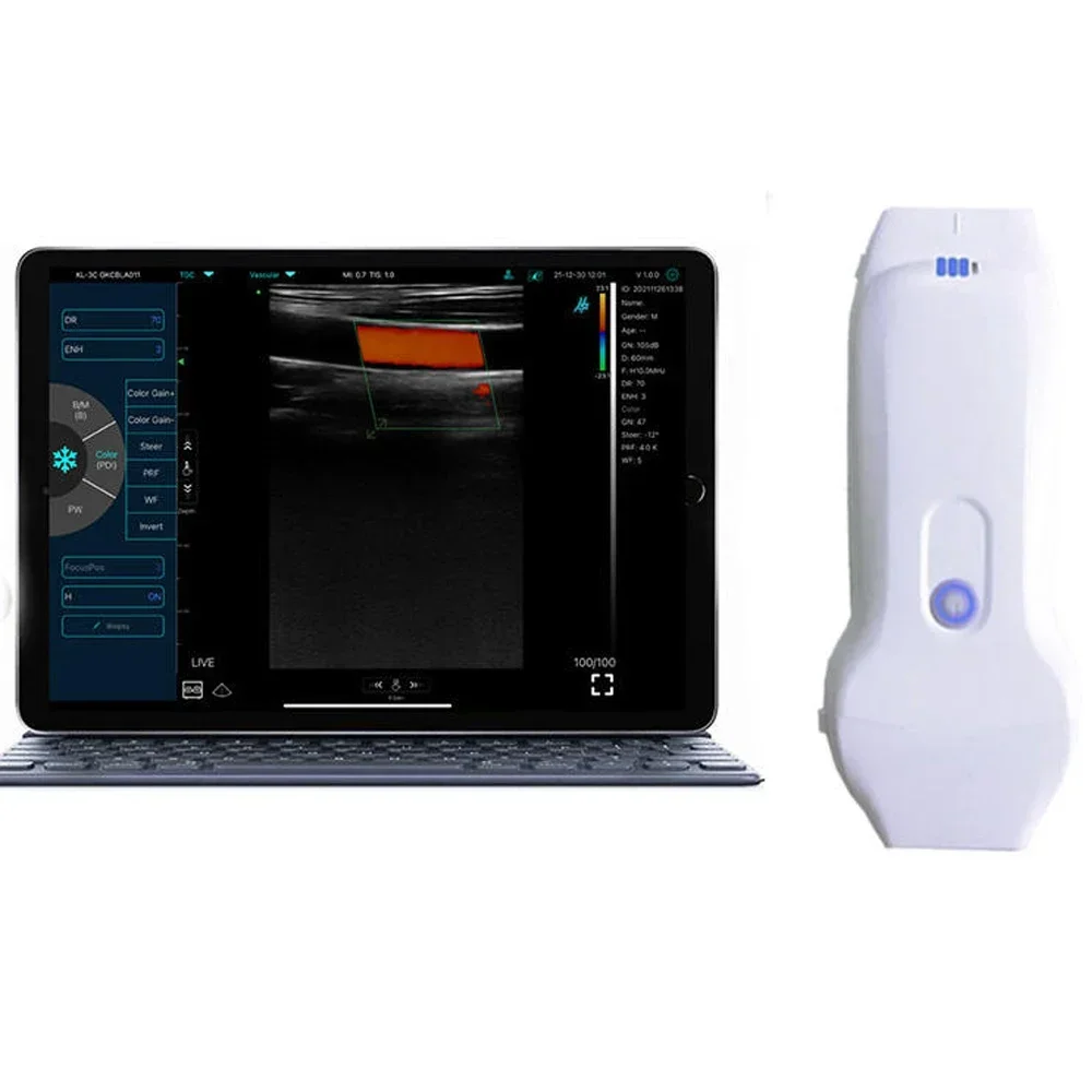 Dual 128 Wifi Ultrasound Multipurpose Linear+cardiac Ultrasound Probe for Blood Vessels, Nerves, Musculoskeletal