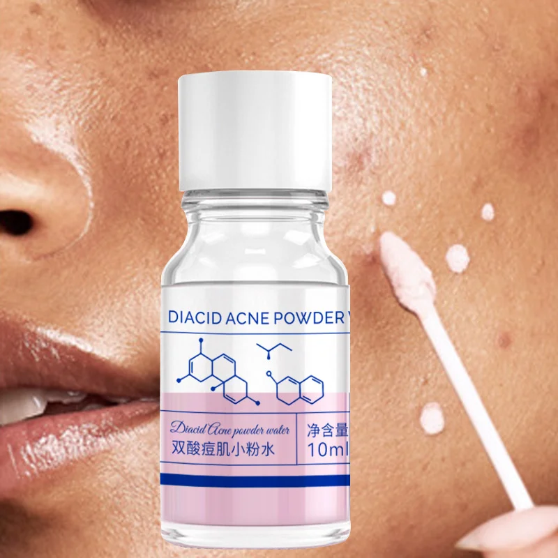 essenza-concentrata-per-l'acne-con-acido-salicilico-rosa-da-10-ml-contiene-acido-salicilico-acido-lattico-calamina-doppia-azione-acida