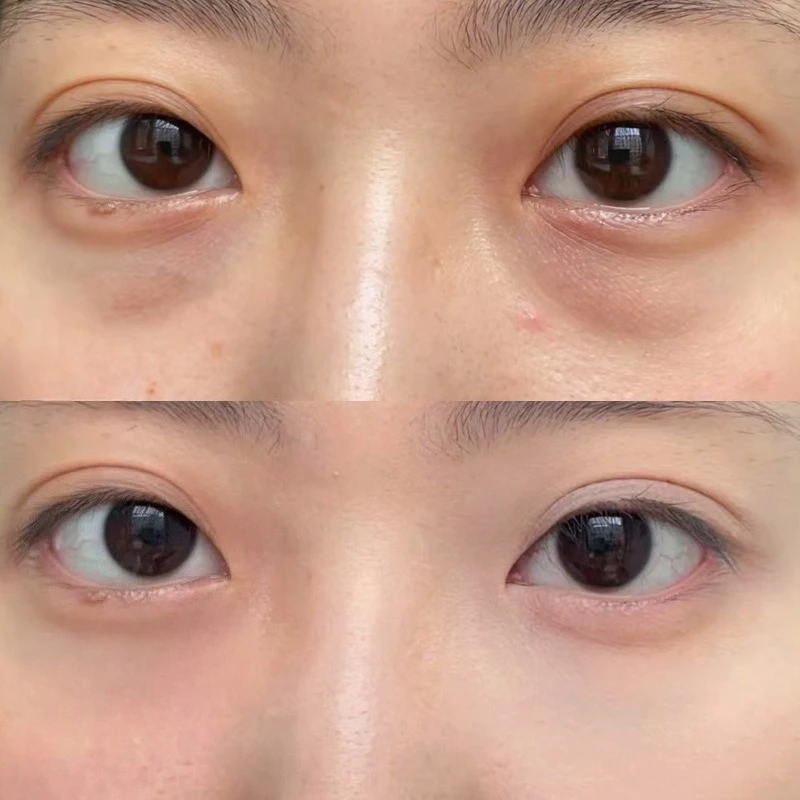 XIXI メイク保持 3 色コンシーラー顔のくま暗い色差ファンデーションクリーム薄くて持久力のあるコンシーラー