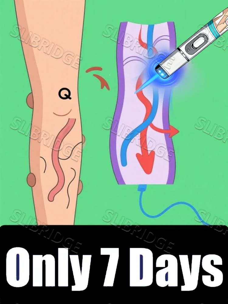 

2025 hot sale Blue light pen Says Goodbye To all veins In 7 Days Leg care tools Reduce Uncomfortable For Legs