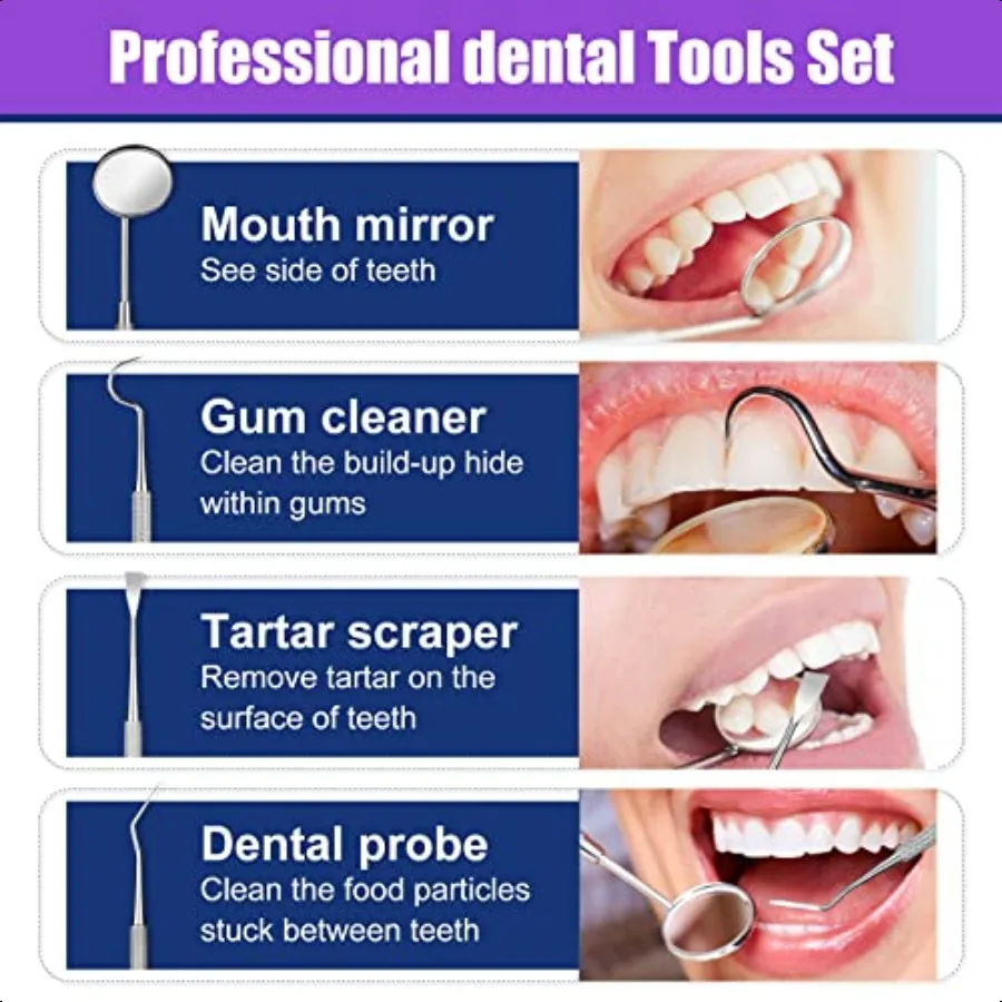 Kit de reparación de dientes, Kit de reparación de relleno de dientes moldeable con 4 herramientas dentales que fijan los reemplazos de dientes faltantes y rotos, Make Yo