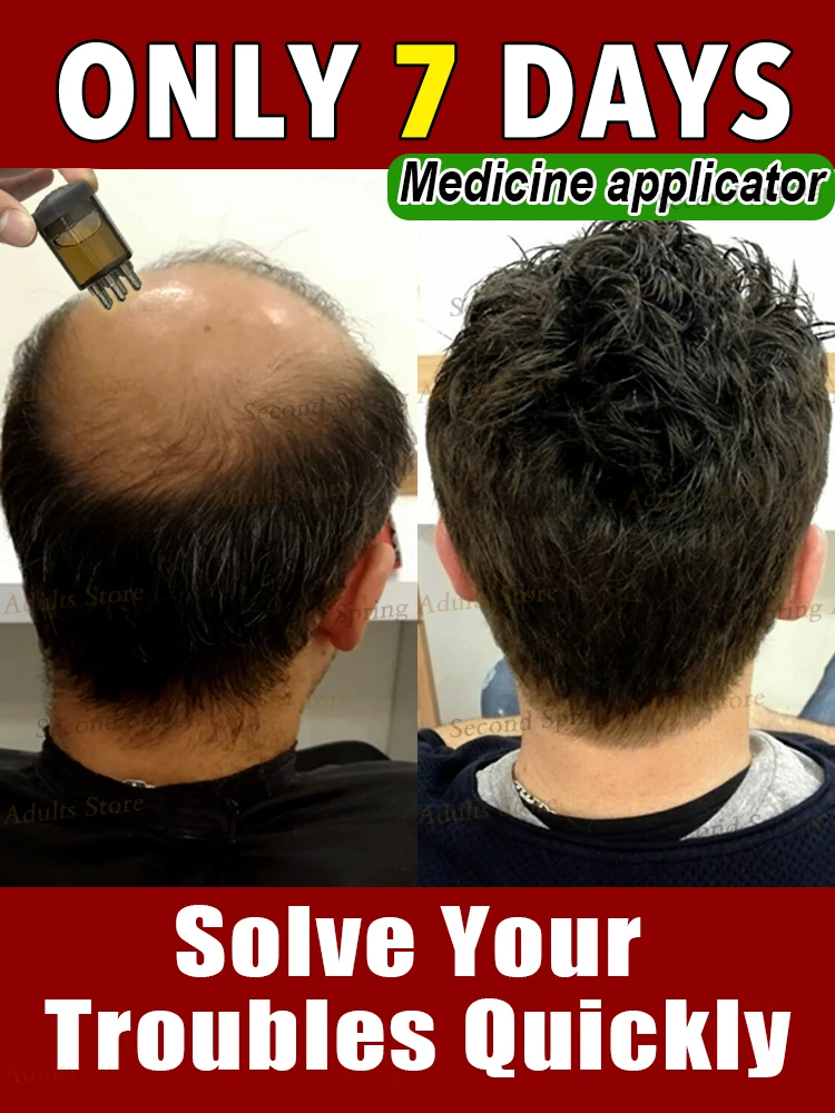 

Scalp Applicator Hair Regrowth & Styling Solution The latest model in 2025 Roller Ball Massage Comb Massage Relaxation Tools