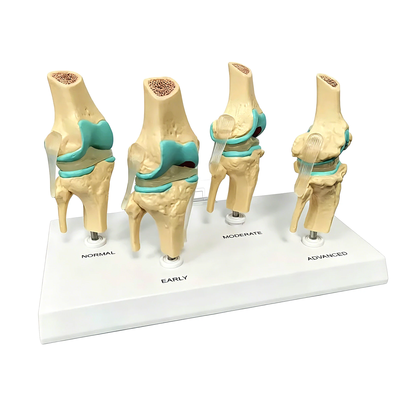 

4-stage knee joint model Plastic Bone Model Of Human Body Teaching Equipment Student Lab Medical Teaching Model PVC Model