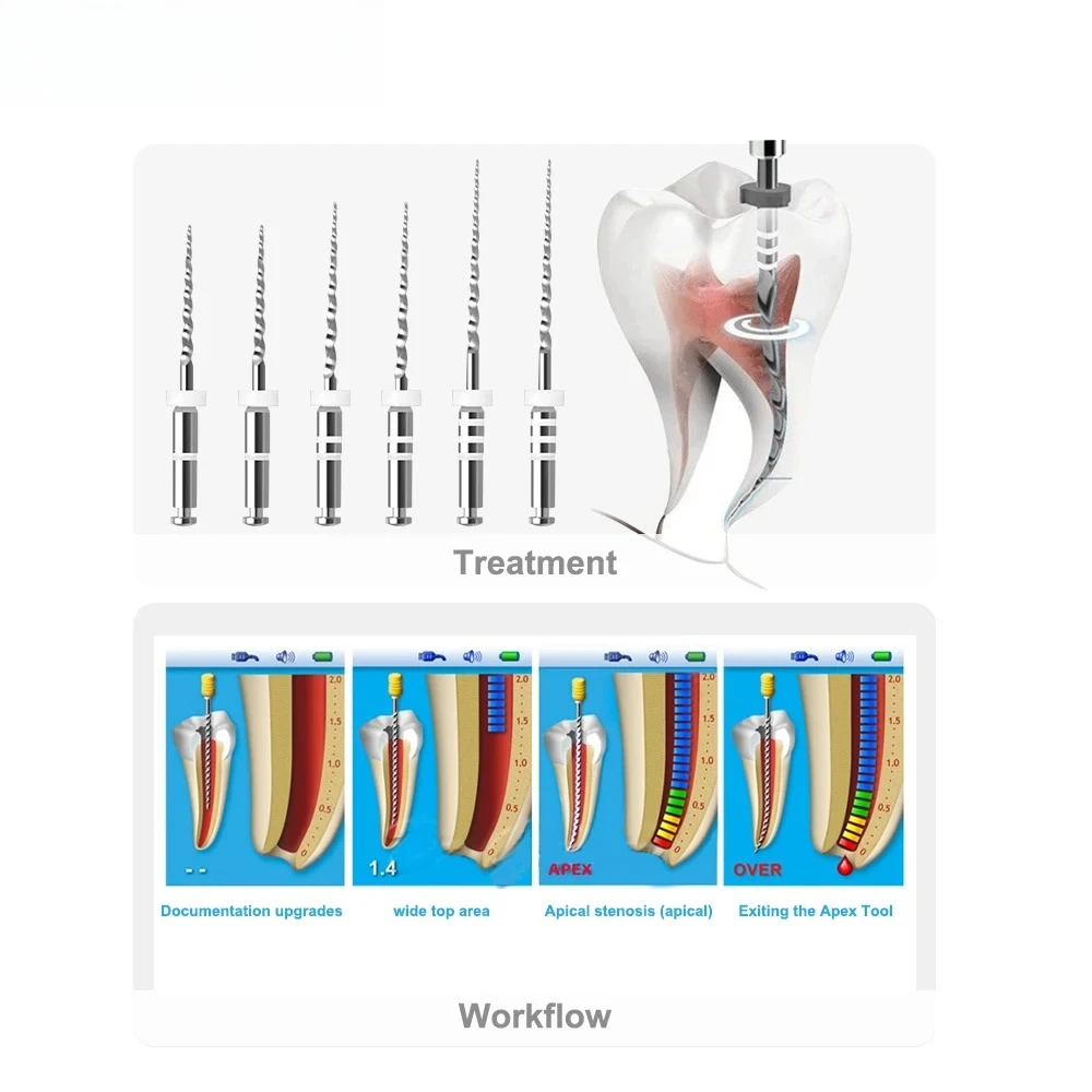 

10Box/Pack SYJH Dental NiTi File D1-D3 Retreatment Engine Root Canal NiTi File Remove Filling Material Before Cleaning Tools