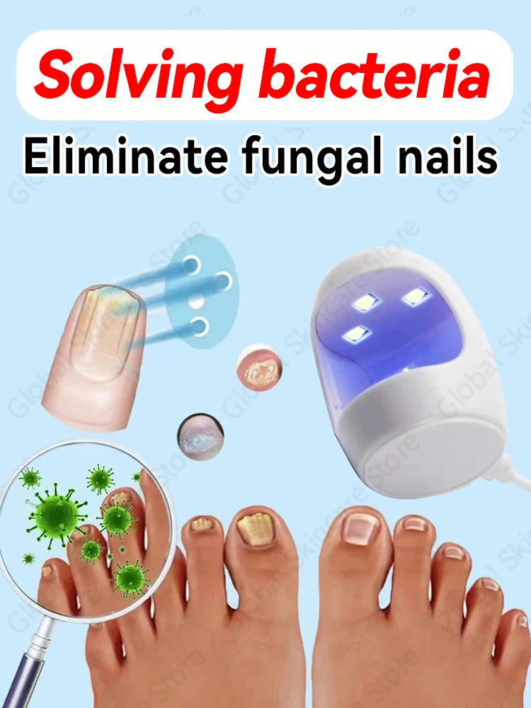 Laser Product To Solves Nail troubles