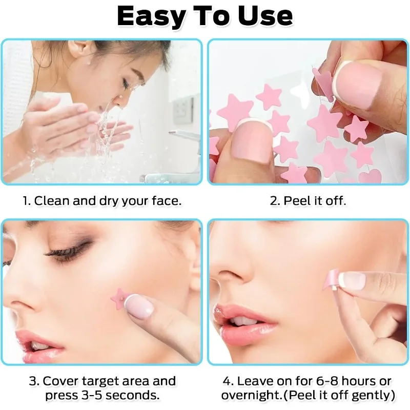 200개 컬러풀 여드름 패치 스티커 방수 여드름 제거 패치 항여드름 하이드로콜로이드 패치 스팟 마크 수리 스티커