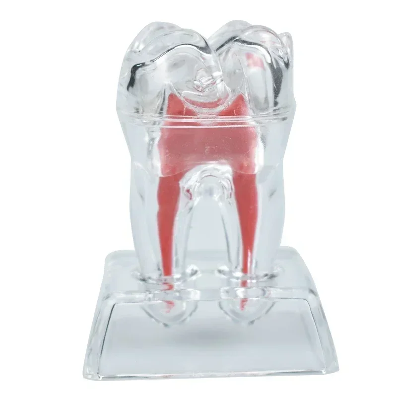

Dental Anatomical Model 4xTeeth Transparent Luminous Detachable Single Tooth Decomposition 70mm Size Dentistry Clinic Ornaments