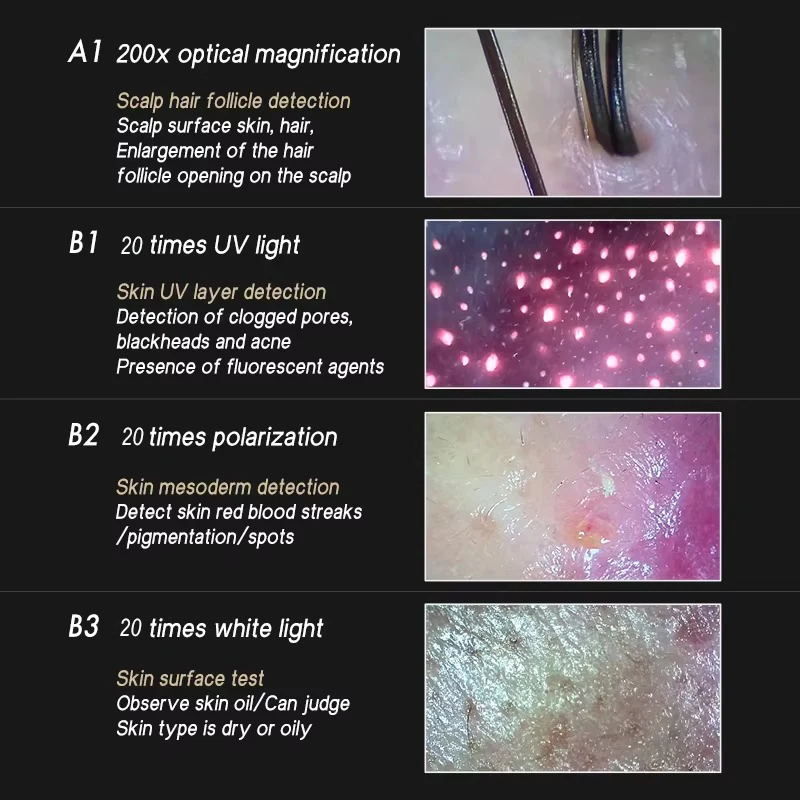 لاسلكي 20X/200X منظار الجلد فروة الرأس آلة تحليل بشرة الوجه الجلد المكبر فروة الرأس أداة تشخيص واي فاي المجهر اختبار الجلد