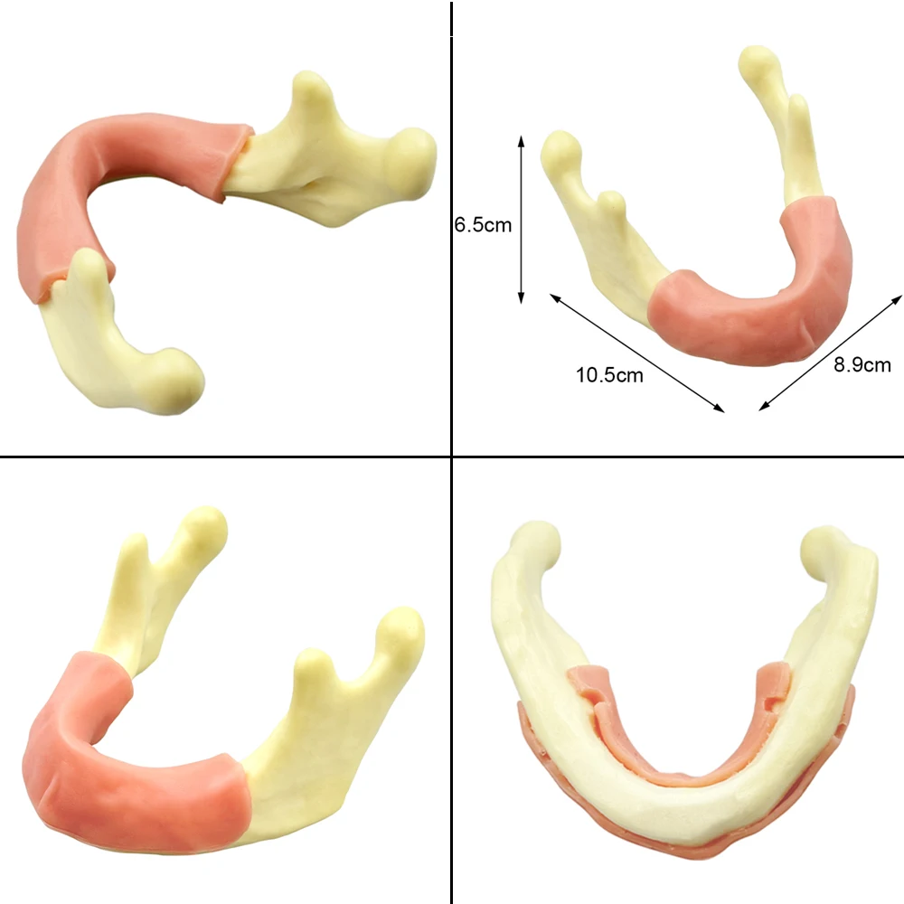

Модель зубного имплантата, верхняя/межневидная пазуха, мягкий имплантат, модель отсутствия зуба, экспериментальная обучающая практика для студентов-стоматолога