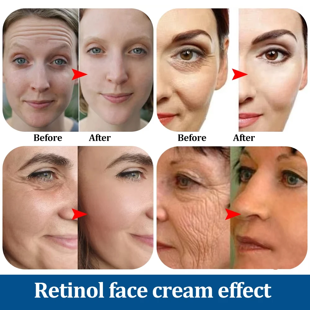 Retinol Instant Wrinkle Remover Face Cream Lifting Firming Fade Fine Lines Hyaluronic Acid Moisturizing Brighten Skin Care 50g