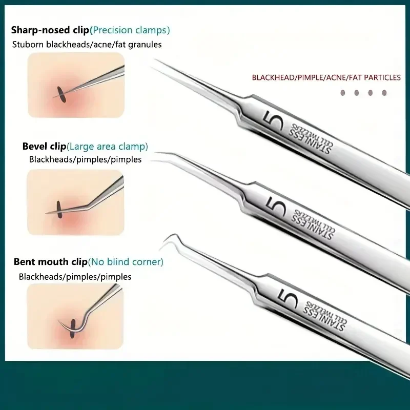 Outil d'aiguille d'acné en acier inoxydable, pince à points noirs d'acné, Salon de beauté 3/8 pièces