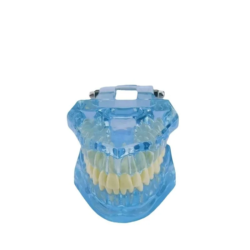 Restoration model, dental pathology, doctor-patient communication, teaching prosthosis, comprehensive removable dental mold