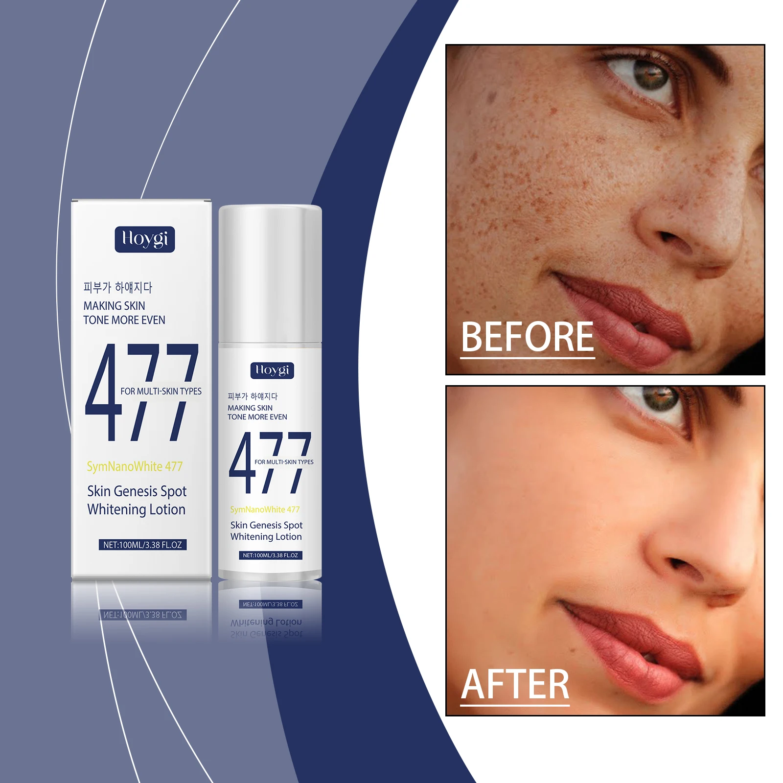 SymNanoWhite 477 Whitening Lotion for Even Skin Tone - Dark Spot Corrector, Brightening Treatment for Face & Body,