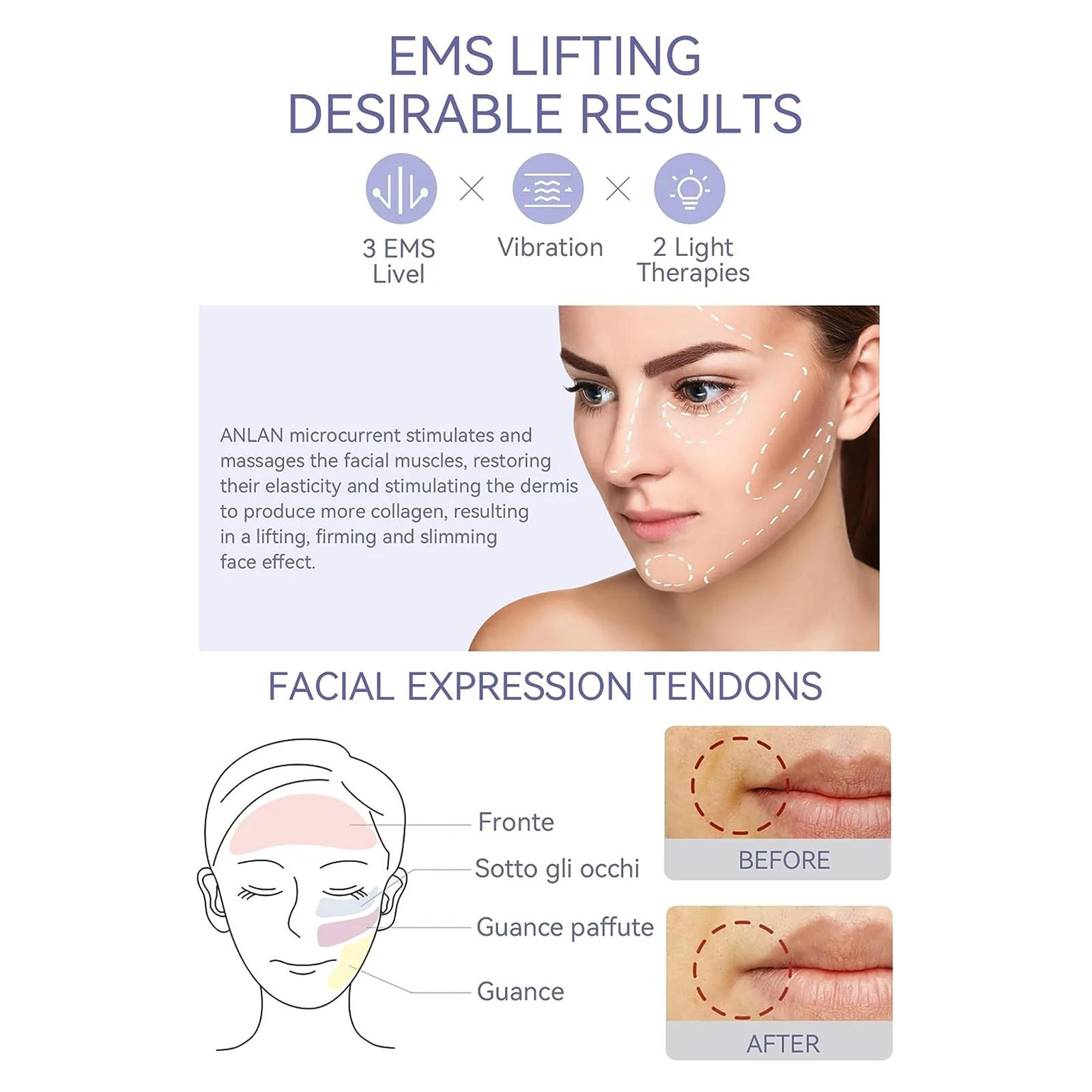 ANLAN Masajeador facial EMS Levantamiento facial Limpieza profunda Cuidado de la piel con luz LED Estiramiento de la piel Compresa fría y caliente