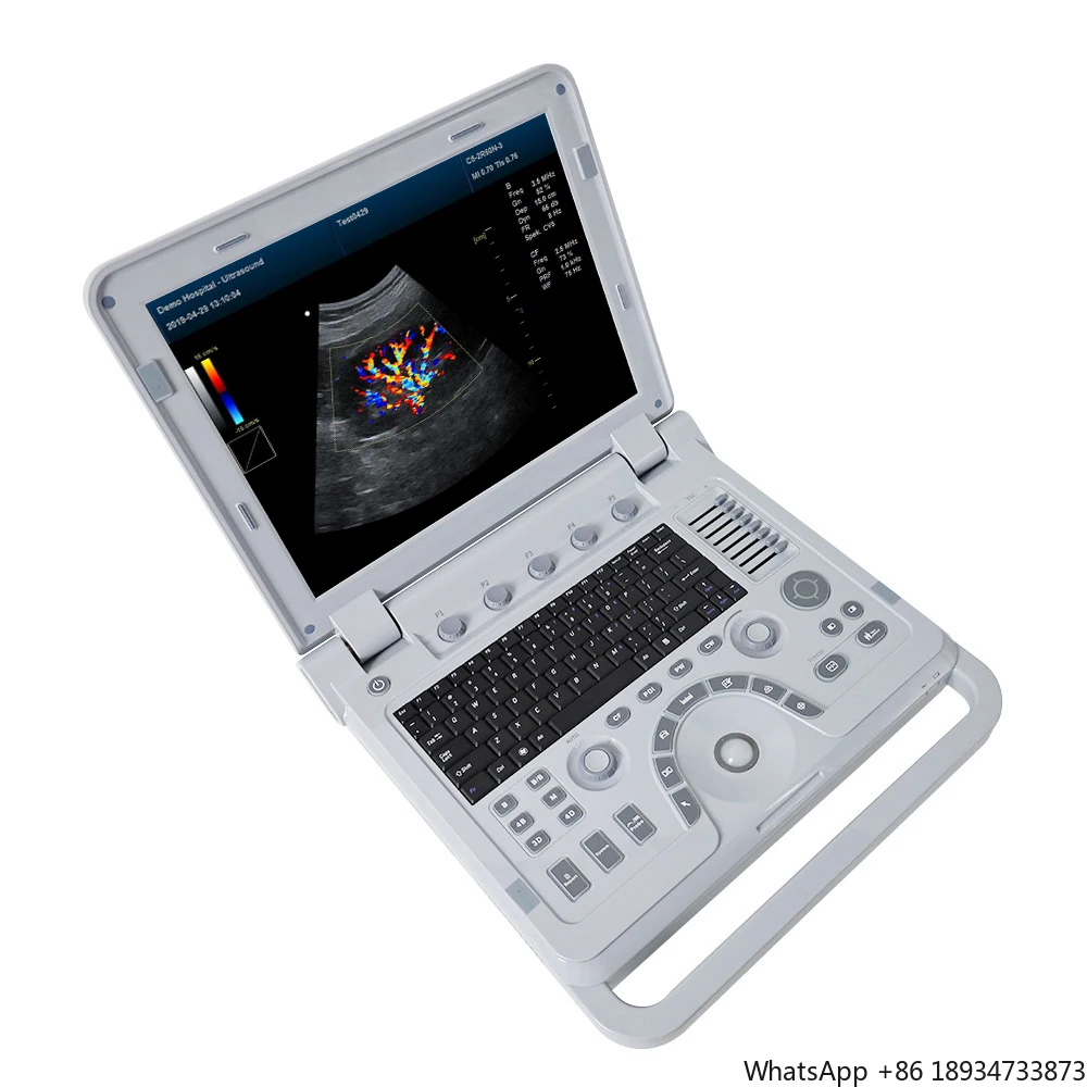 CMS1700B ultrasonic sonography color doppler tissue continuous pulsed doppler parameters continous doppler