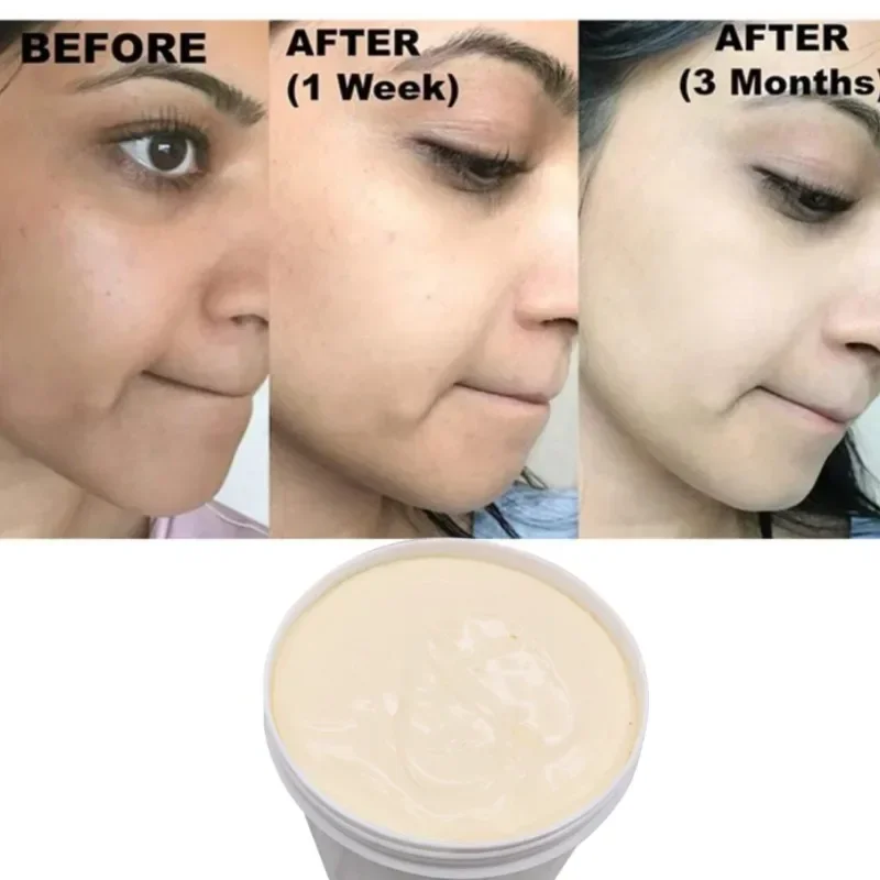 1KG Strong Effective Best Bleaching Whitening Cream Facial Neck Hands Feet Without Side Effects Dark Black Skin Bleaching Cream