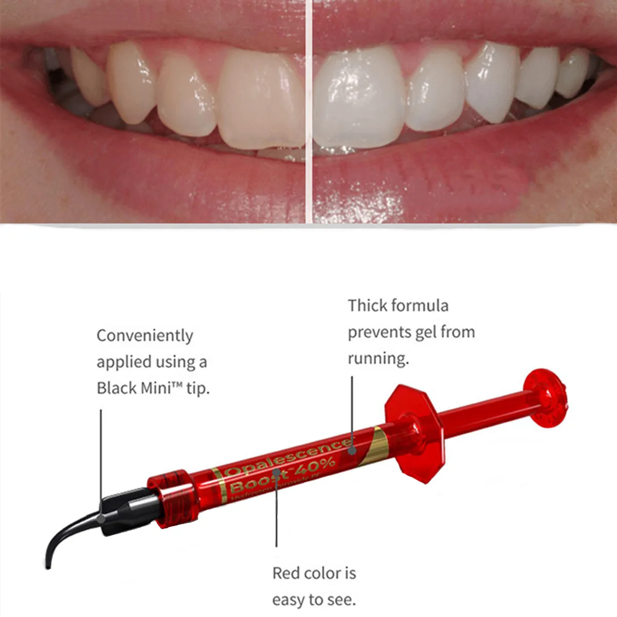 Opalescence Boost 40% PF Ultradent Blanchiment Office Peroxide Dental Professional Teeth Bleaching Gel Dentistry Tools