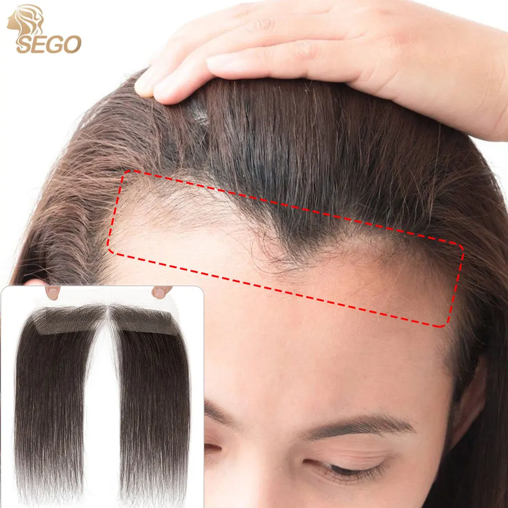 SEGO 0.75” X 6.25” Natural Human Hair Full Lace Hand-Tied Front Hairline For Women Human Hair Patches 10\