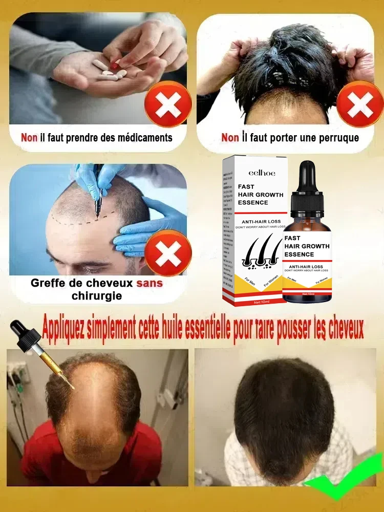 Você precisa de um penteado!! O cabelo fica mais e mais, diga adeus à calvície, cabelo torna-se mais grosso, produtos mais vendidos.