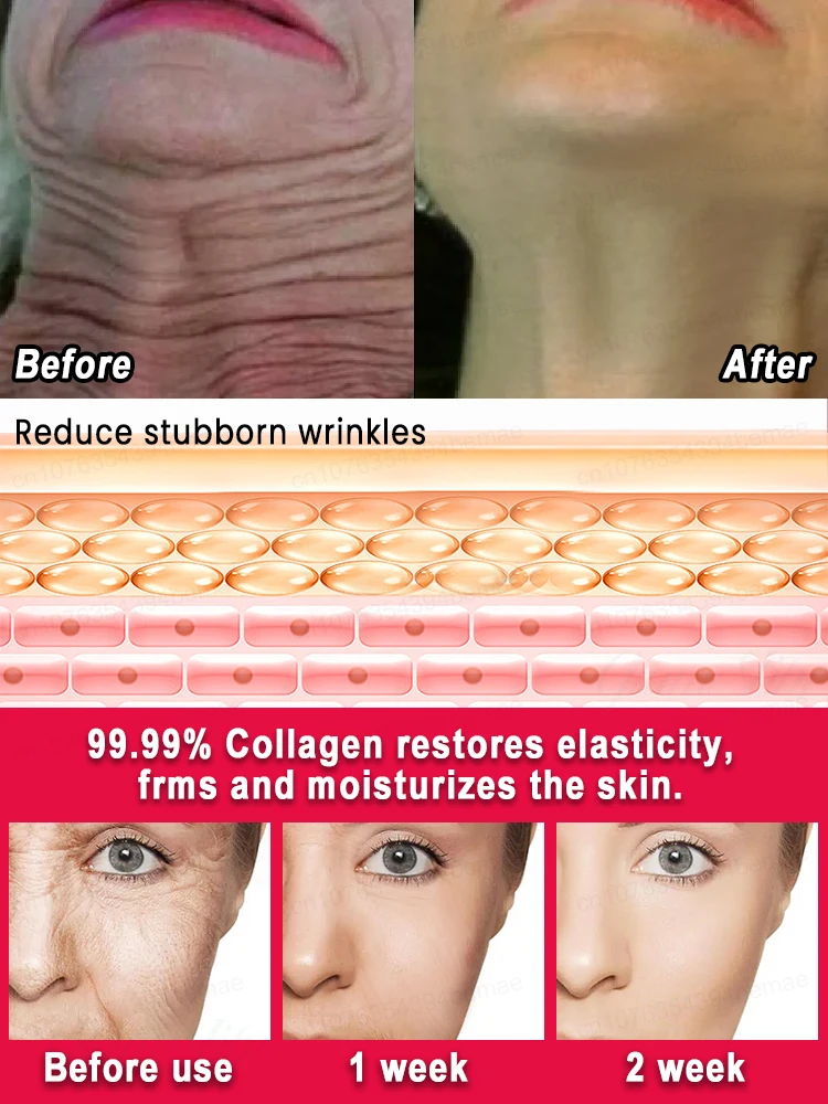 2025年ベストセラー すべてのしわが消える