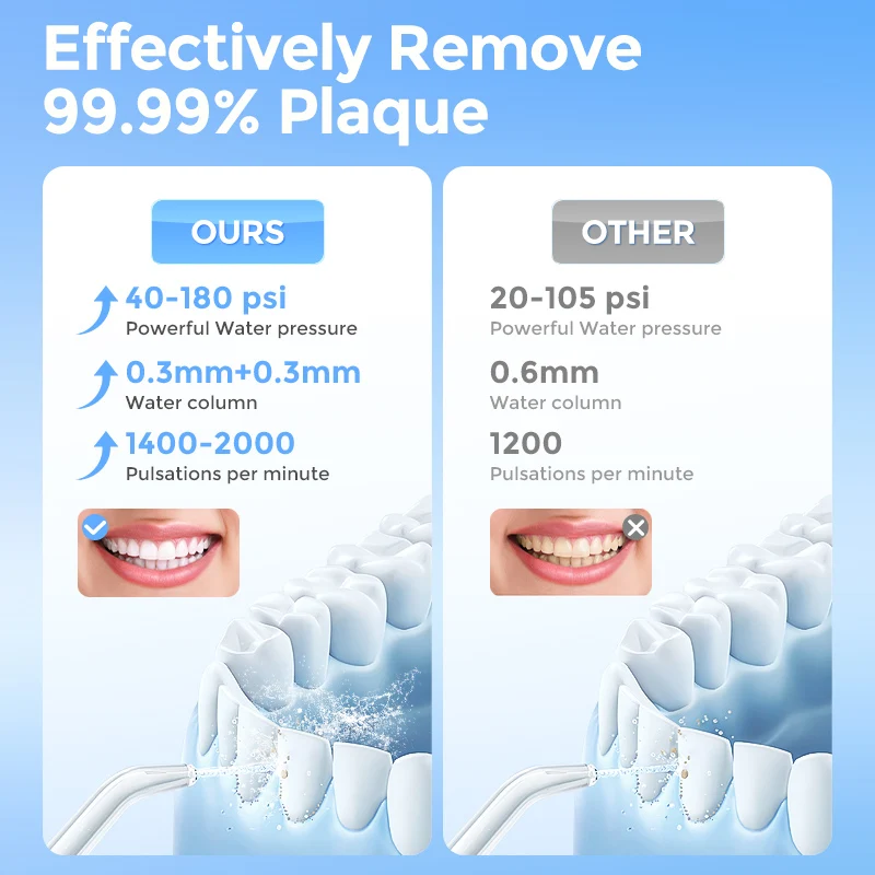 Thumbnail 4 - #36 Best Rated Dental Water Jets to Buy in 2026
