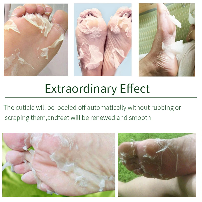 Lavender & VC Foot Peeling Mask Exfoliating Heels Calluses Remove Foot Patches Dead Skin Remover Pedicure Socks Foot Care 1Pair