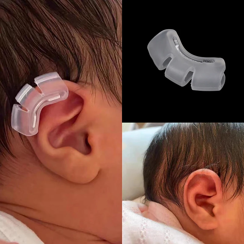 1 قطعة الطفل الأذن دعم الخارجي الأذن مصحح جاحظ الطفل الأذن مصحح الطفل الخارجي الأذن مصحح بطانة للأذن