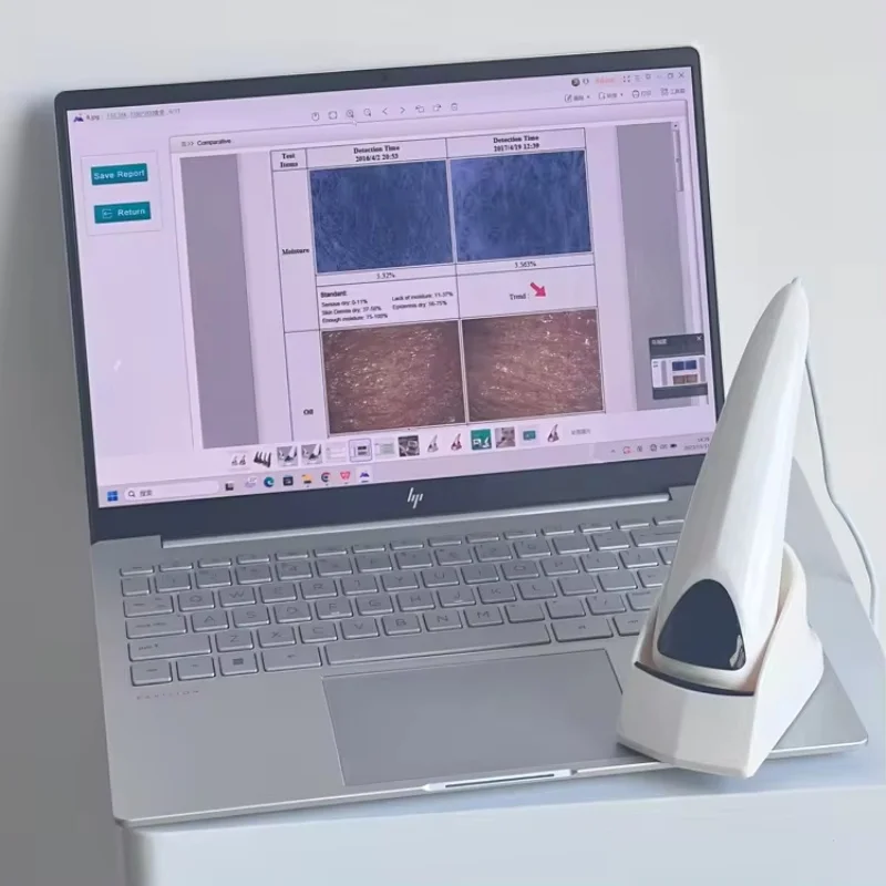 High-Definition Pixel Draagbare Esthetische Huidanalysator Automatische Diagnose Gezichts Epidermis Huidmicroscoop Salon Schoonheid