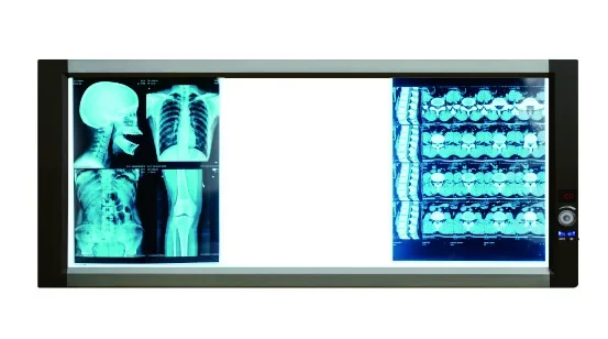 Ultra cienki 2-bankowy LED negatoskop dentystyczny medyczny przeglądarka filmów rentgenowskich z CE z ISO13485 z trzema latami gwarancji