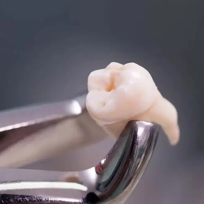 

Stainless Steel Dental Extraction Forceps Pliers kit for Adult, 7pcs/set Surgical Teeth Extraction Forcep for Children