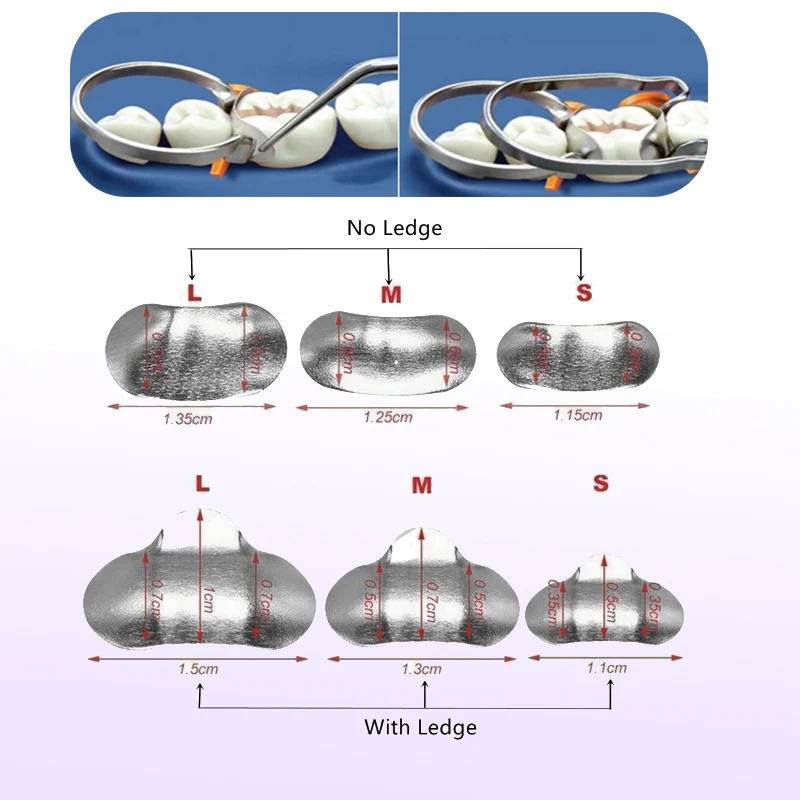 100Pcs/Pack Dental Sectional Contoured Matrices Matrix Bands Tofflemire Stuck S/M/L Dental Lab Dentistry