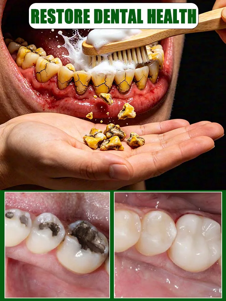 7-Day Toothpaste Cleaning Management—Quickly relieves discomfort and helps repair minor damage.