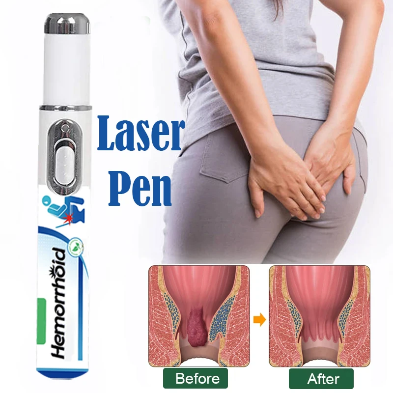 Hämorrhoiden Medizinische Laser Stift Reparatur Anal Weiche Gewebe Blutungen Stoppen Effektive Anti Schwellungen Schmerzen Relief Laser Pointer Gesundheit Pflege